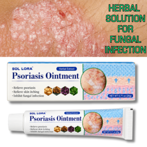 SOL LORA Psoriasis Ointment Herbal Extract Cream for Skin Itching & Psoriasis Relief – 20g