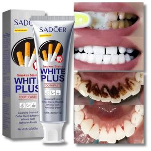 SADOER White Plus Toothpaste - Smokes & Coffee Stains Removal (100g)